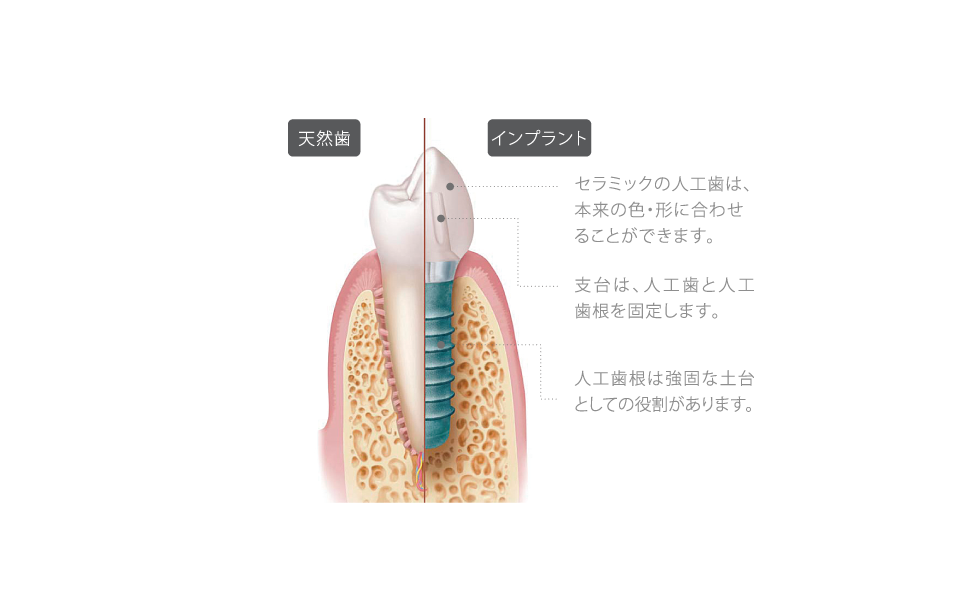 歯